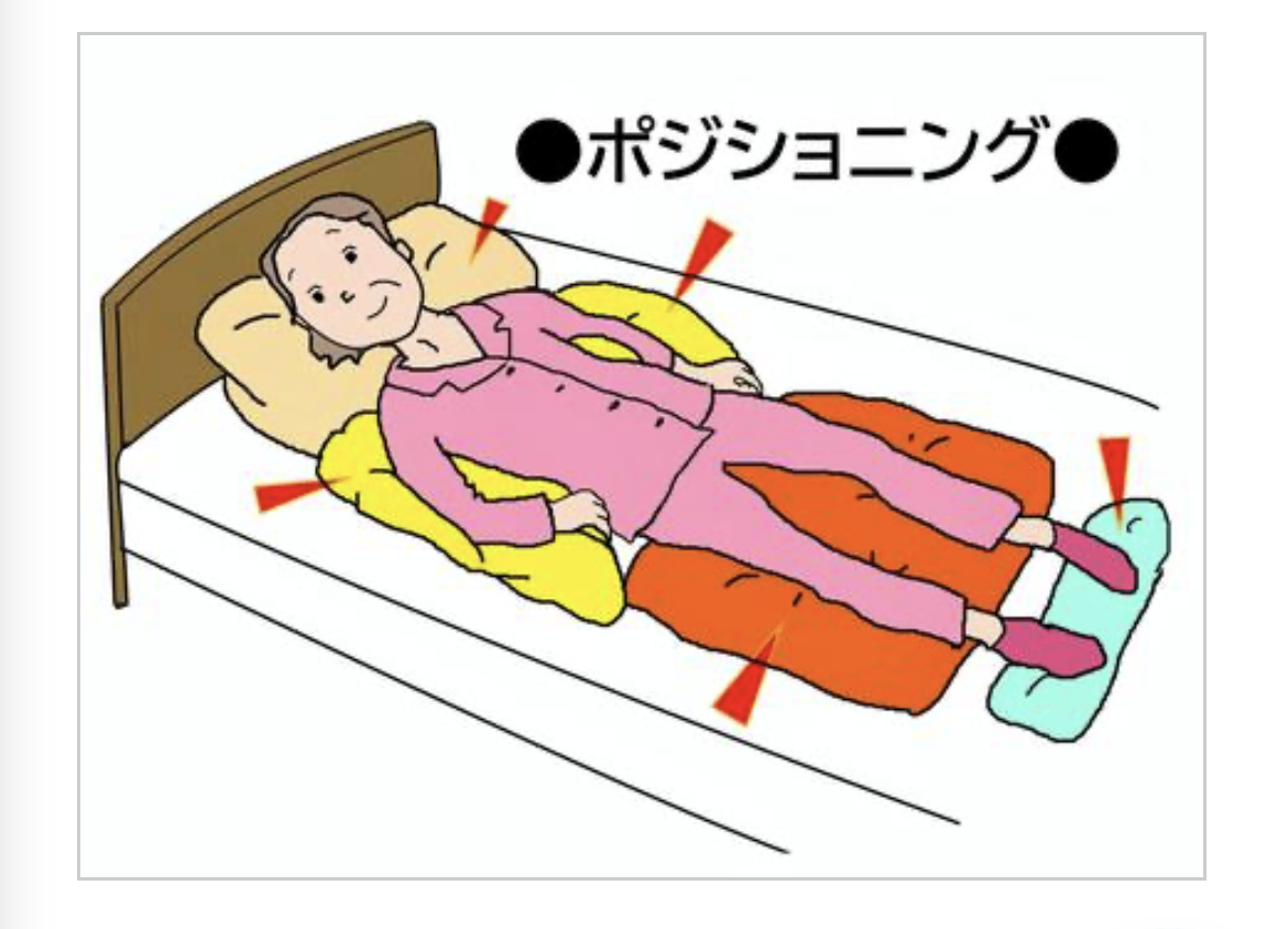 仰臥位ポジショニング全体図